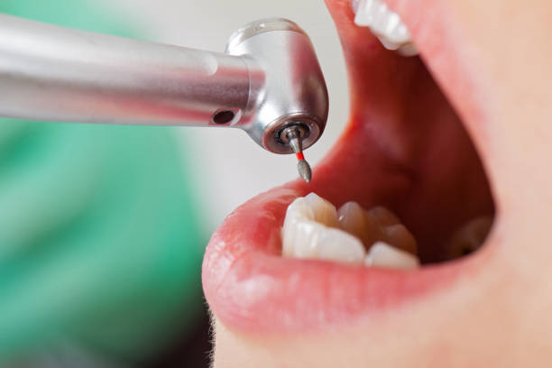 Best Emergency Dental Extractions in St John, MO
